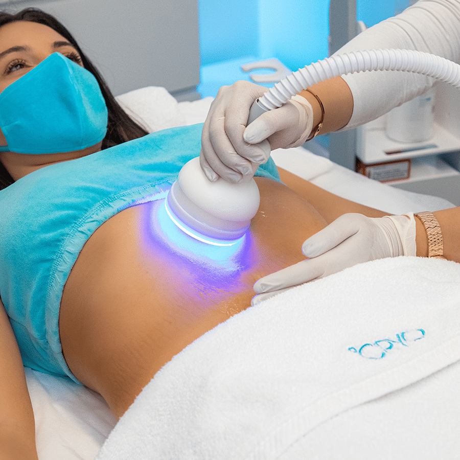 cryotherapy slimming sydney
